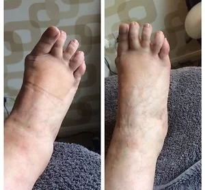 Lesley Tucker Reflexology